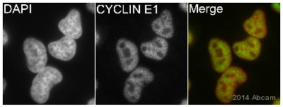 Immunocytochemistry/ Immunofluorescence - Anti-Cyclin E1 antibody [EPR194] - BSA and Azide free (AB208695)