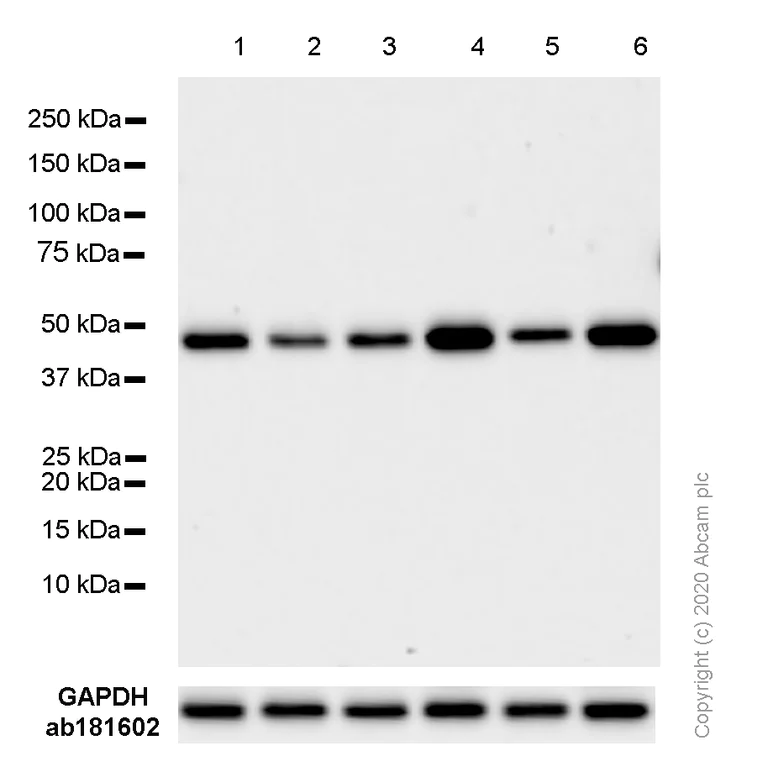 Western blot - Anti-Cyclin E1 antibody [EPR20777-118] - BSA and Azide free (Detector) (AB244991)