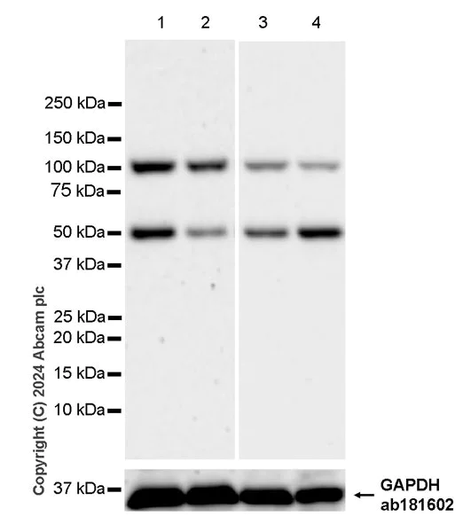 Western blot - Anti-Cyclin E1 antibody [EPR25394-23] - BSA and Azide free (AB317437)