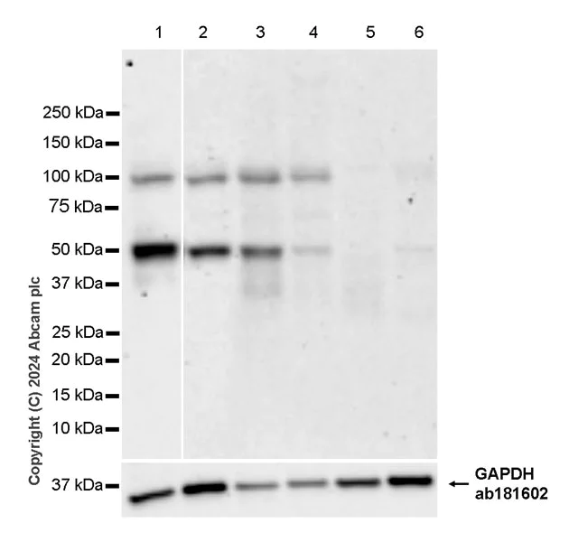 Western blot - Anti-Cyclin E1 antibody [EPR25394-23] - BSA and Azide free (AB317437)