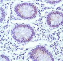 Anti-Cyclin E1 antibody [SP146]
