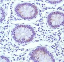Immunohistochemistry (Formalin/PFA-fixed paraffin-embedded sections) - Anti-Cyclin E1 antibody [SP146] (AB135380)