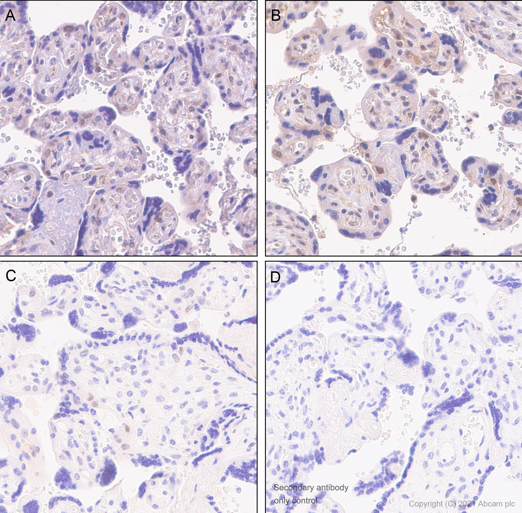 Immunohistochemistry (Formalin/PFA-fixed paraffin-embedded sections) - Anti-Cyclin E1 antibody [SP146] (AB135380)