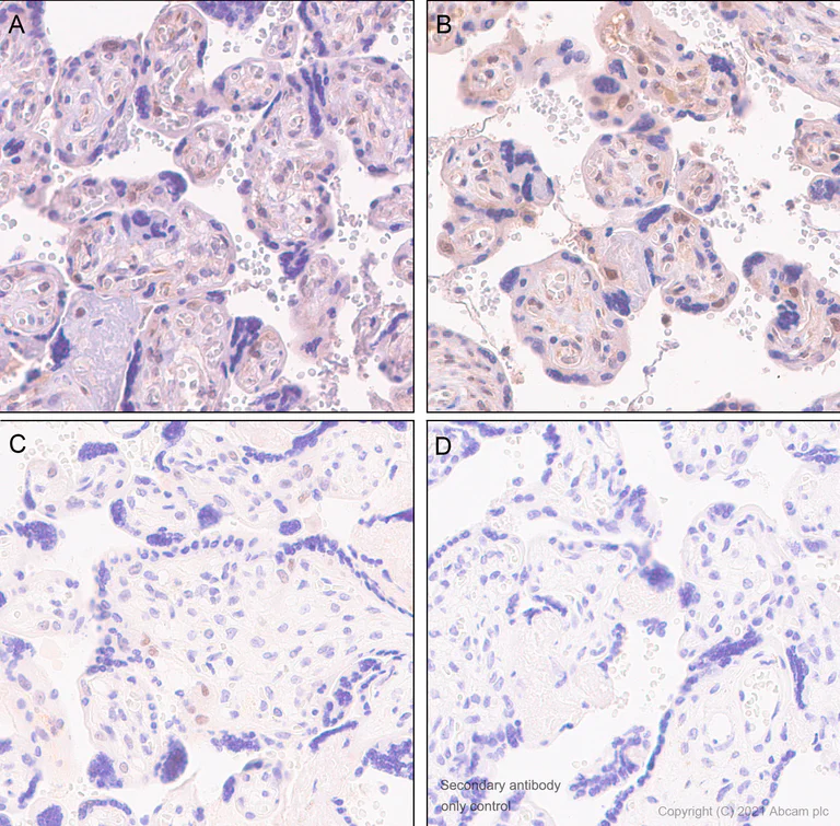 Immunohistochemistry (Formalin/PFA-fixed paraffin-embedded sections) - Anti-Cyclin E1 antibody [SP146] (AB135380)