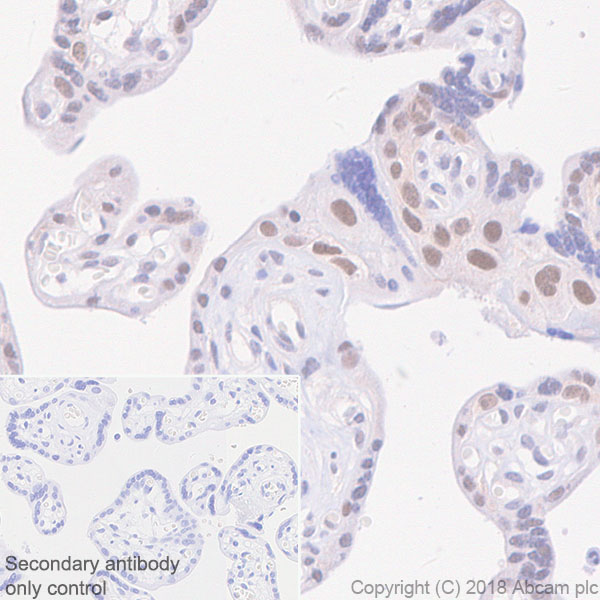 Immunohistochemistry (Formalin/PFA-fixed paraffin-embedded sections) - Anti-Cyclin E1 antibody [SP146] - BSA and Azide free (AB245729)