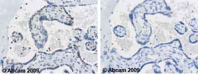 Immunohistochemistry (Formalin/PFA-fixed paraffin-embedded sections) - Anti-Cyclin E1 (phospho T395) antibody (AB52195), expandable thumbnail