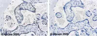 Immunohistochemistry (Formalin/PFA-fixed paraffin-embedded sections) - Anti-Cyclin E1 (phospho T395) antibody (AB52195)