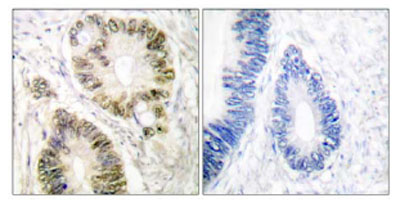 Immunohistochemistry (Formalin/PFA-fixed paraffin-embedded sections) - Anti-Cyclin E1 (phospho T395) antibody (AB52195), expandable thumbnail