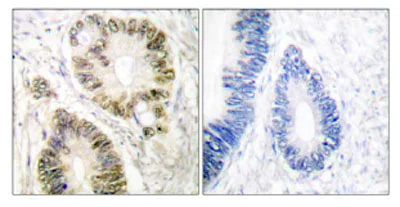 Immunohistochemistry (Formalin/PFA-fixed paraffin-embedded sections) - Anti-Cyclin E1 (phospho T395) antibody (AB52195)
