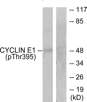 Western blot - Anti-Cyclin E1 (phospho T395) antibody (AB52195)