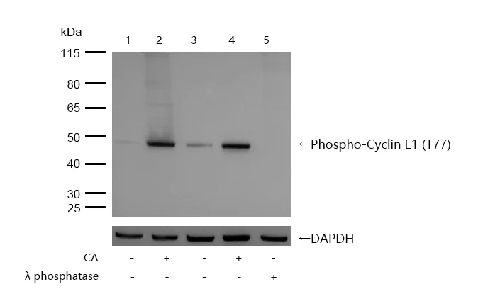 Western blot - Anti-Cyclin E1 (phospho T77) antibody [SD2025] (AB326630)