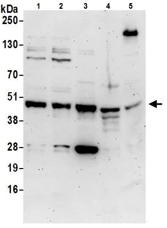 Western blot - Anti-Cyclin E2 antibody (AB226388)