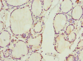 Immunohistochemistry (Formalin/PFA-fixed paraffin-embedded sections) - Anti-Cyclin E2 antibody (AB236106)