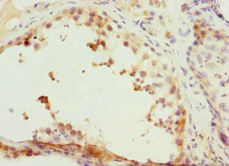 Immunohistochemistry (Formalin/PFA-fixed paraffin-embedded sections) - Anti-Cyclin E2 antibody (AB236106)