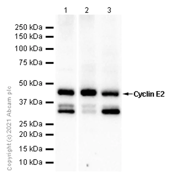 Western blot - Anti-Cyclin E2 antibody [E142] - BSA and Azide free (AB228478)
