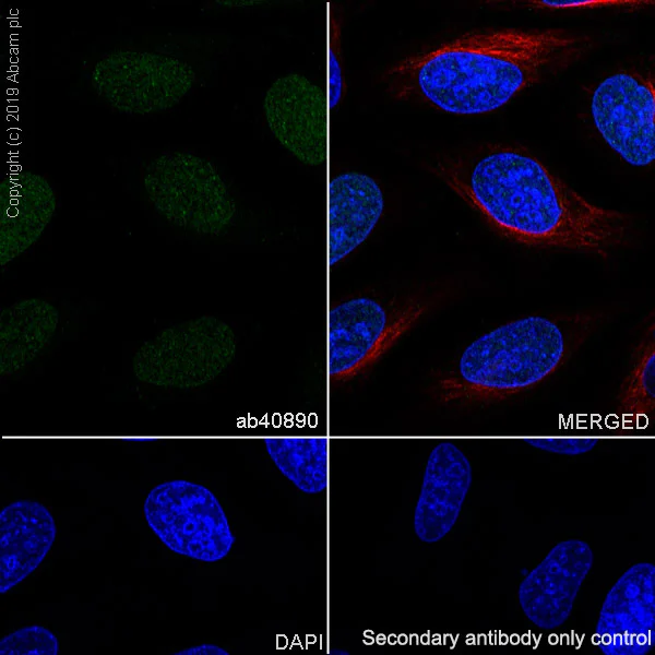 Immunocytochemistry/ Immunofluorescence - Anti-Cyclin E2 antibody [EP454Y] (AB40890)