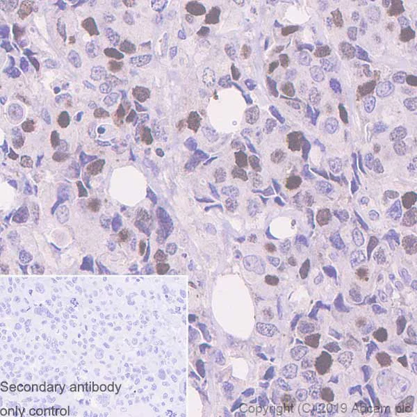 Immunohistochemistry (Formalin/PFA-fixed paraffin-embedded sections) - Anti-Cyclin E2 antibody [EP454Y] (AB40890)