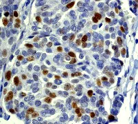 Immunohistochemistry (Formalin/PFA-fixed paraffin-embedded sections) - Anti-Cyclin E2 antibody [EP454Y] (AB40890)