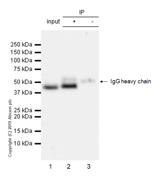 Immunoprecipitation - Anti-Cyclin E2 antibody [EP454Y] (AB40890)