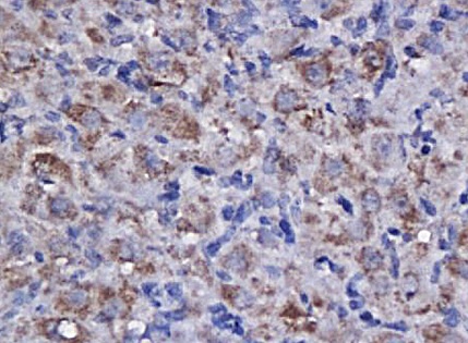 Immunohistochemistry (Formalin/PFA-fixed paraffin-embedded sections) - Anti-Cyclin F antibody (AB203117)
