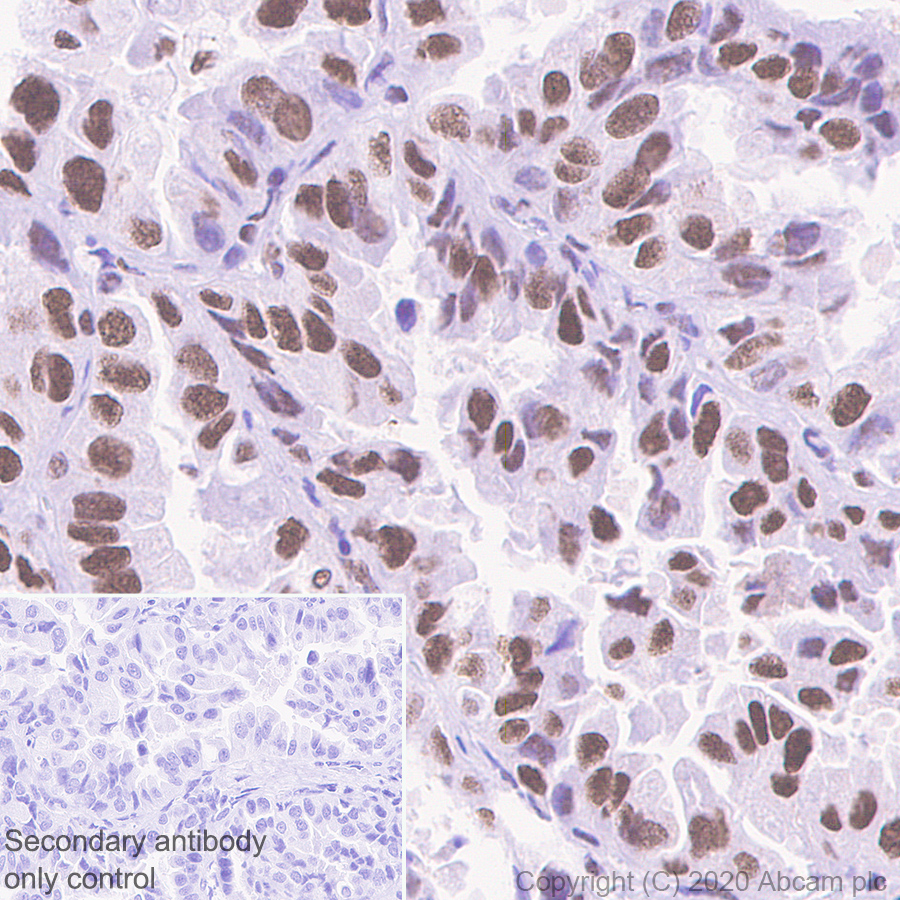 Immunohistochemistry (Formalin/PFA-fixed paraffin-embedded sections) - Anti-Cyclin H/p34 antibody [EPR3929] - BSA and Azide free (AB247551), expandable thumbnail