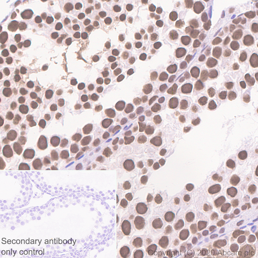 Immunohistochemistry (Formalin/PFA-fixed paraffin-embedded sections) - Anti-Cyclin H/p34 antibody [EPR3929] - BSA and Azide free (AB247551), expandable thumbnail