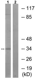 Western blot - Anti-Cyclin H/p34 (phospho T315) antibody (AB73208)