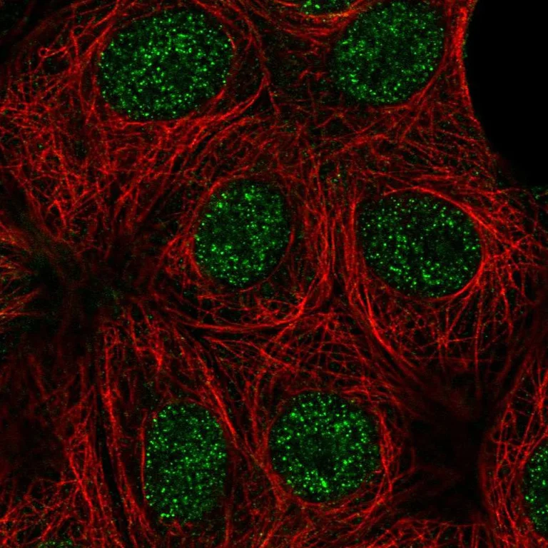 Immunocytochemistry/ Immunofluorescence - Anti-Cyclin K antibody (AB251652)
