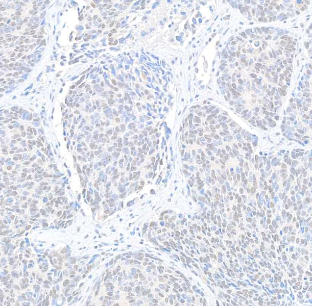 Immunohistochemistry (Formalin/PFA-fixed paraffin-embedded sections) - Anti-Cyclin K antibody (AB85854)