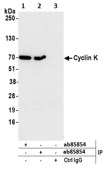 Immunoprecipitation - Anti-Cyclin K antibody (AB85854)