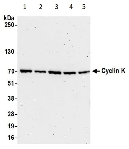 Western blot - Anti-Cyclin K antibody (AB85854)