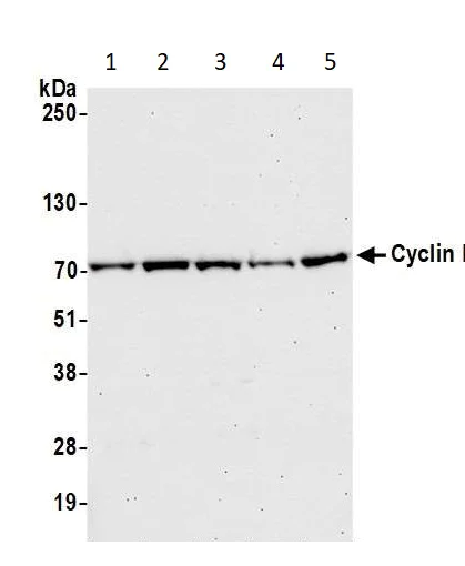 Western blot - Anti-Cyclin K antibody (AB85854)