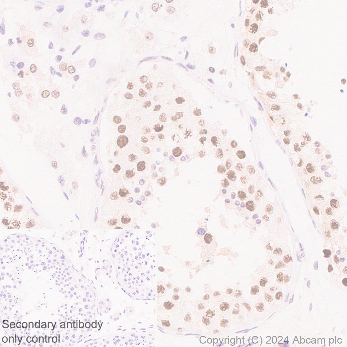Immunohistochemistry (Formalin/PFA-fixed paraffin-embedded sections) - Anti-Cyclin K antibody [EPR28514-24] - BSA and Azide free (ab316204), expandable thumbnail