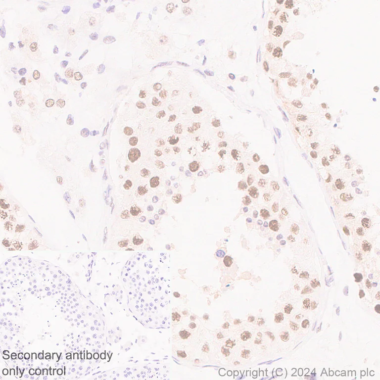 Immunohistochemistry (Formalin/PFA-fixed paraffin-embedded sections) - Anti-Cyclin K antibody [EPR28514-24] - BSA and Azide free (AB316204)