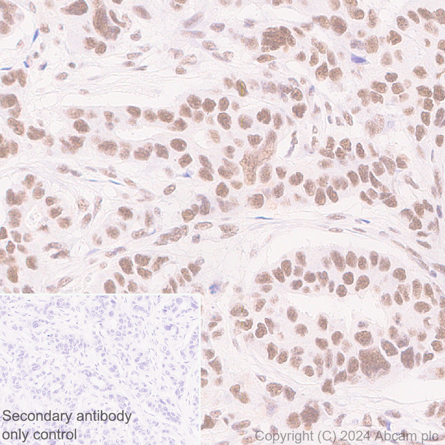Immunohistochemistry (Formalin/PFA-fixed paraffin-embedded sections) - Anti-Cyclin K antibody [EPR28514-24] - BSA and Azide free (ab316204), expandable thumbnail
