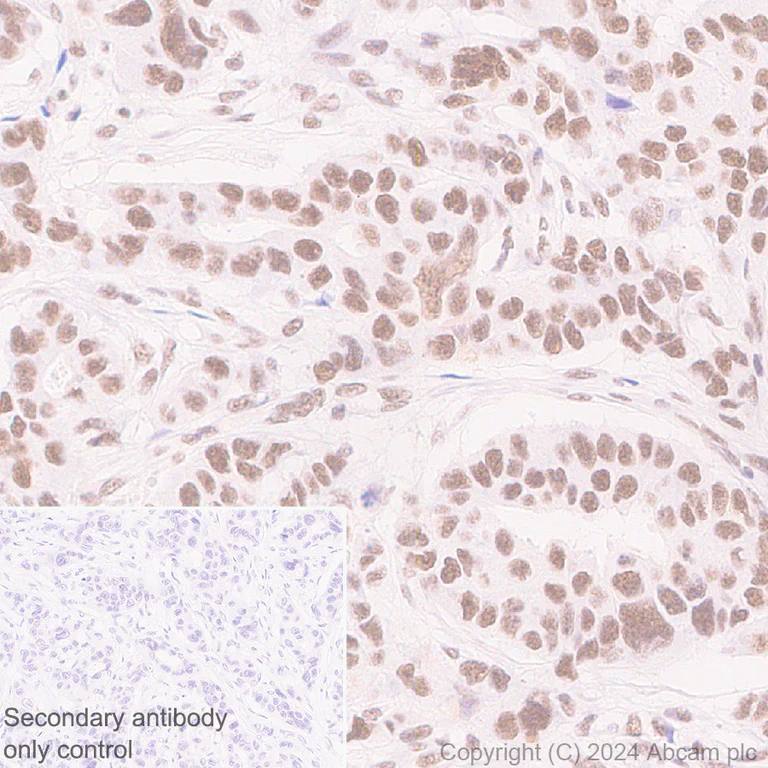 Immunohistochemistry (Formalin/PFA-fixed paraffin-embedded sections) - Anti-Cyclin K antibody [EPR28514-24] - BSA and Azide free (AB316204)