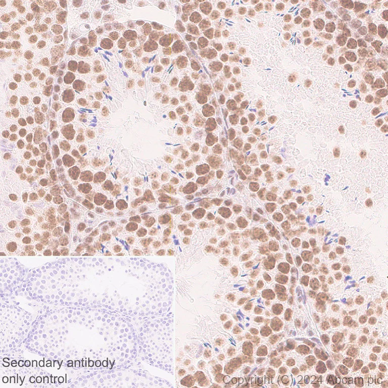 Immunohistochemistry (Formalin/PFA-fixed paraffin-embedded sections) - Anti-Cyclin K antibody [EPR28514-24] - BSA and Azide free (AB316204)