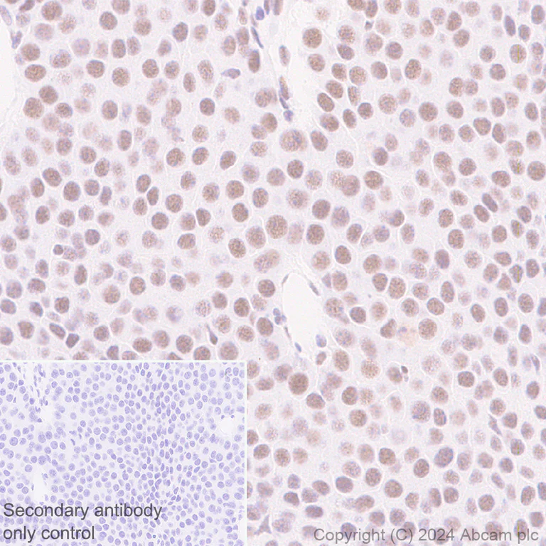 Immunohistochemistry (Formalin/PFA-fixed paraffin-embedded sections) - Anti-Cyclin K antibody [EPR28514-24] - BSA and Azide free (AB316204)