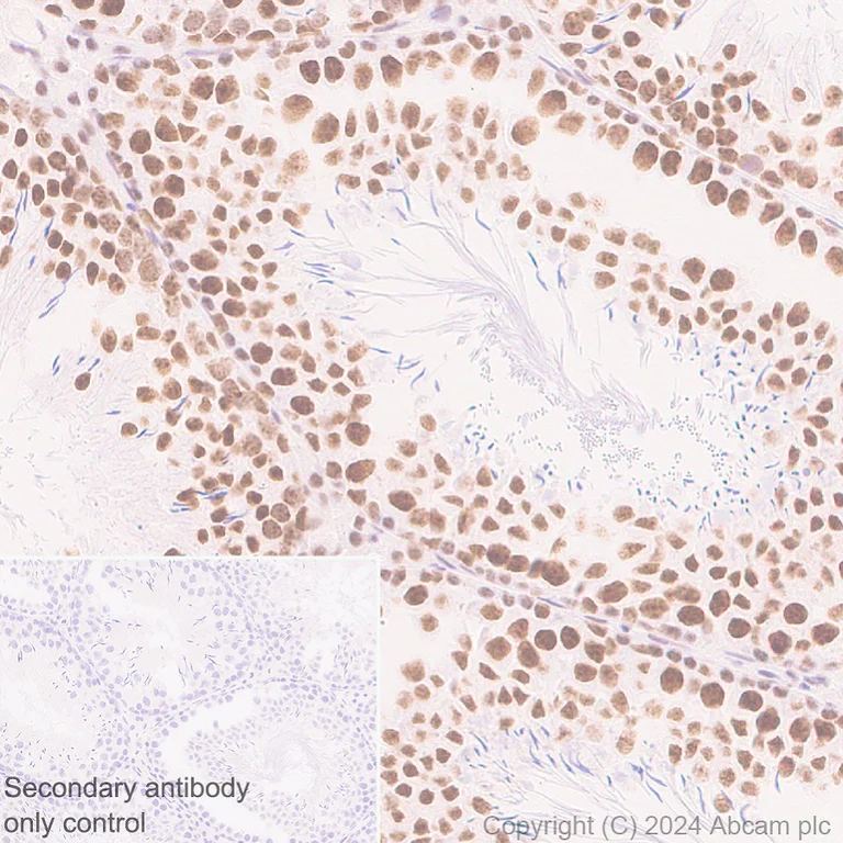 Immunohistochemistry (Formalin/PFA-fixed paraffin-embedded sections) - Anti-Cyclin K antibody [EPR28514-24] - BSA and Azide free (AB316204)