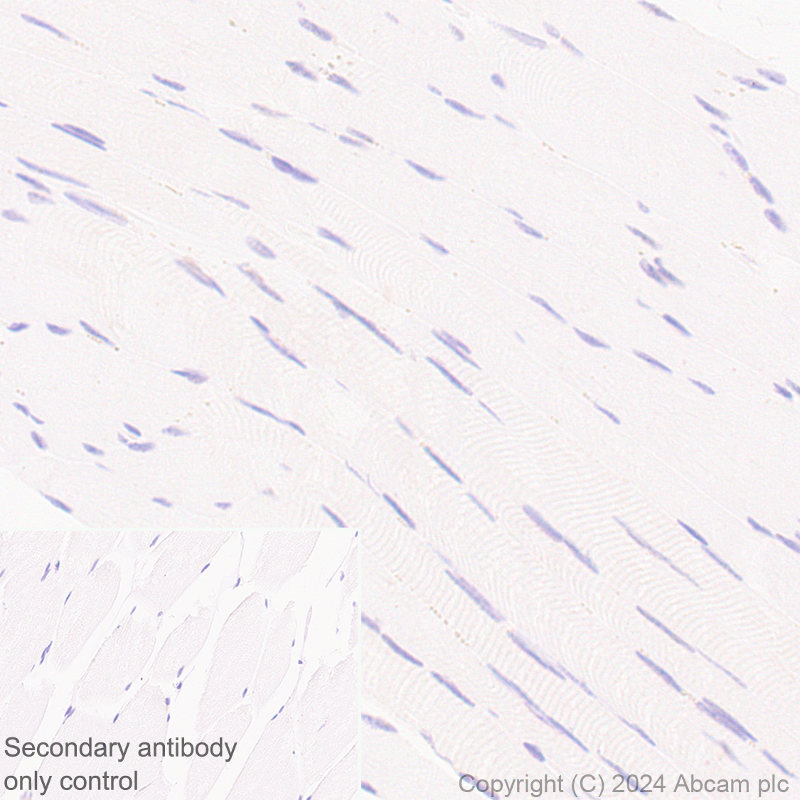 Immunohistochemistry (Formalin/PFA-fixed paraffin-embedded sections) - Anti-Cyclin K antibody [EPR28514-24] - BSA and Azide free (ab316204), expandable thumbnail