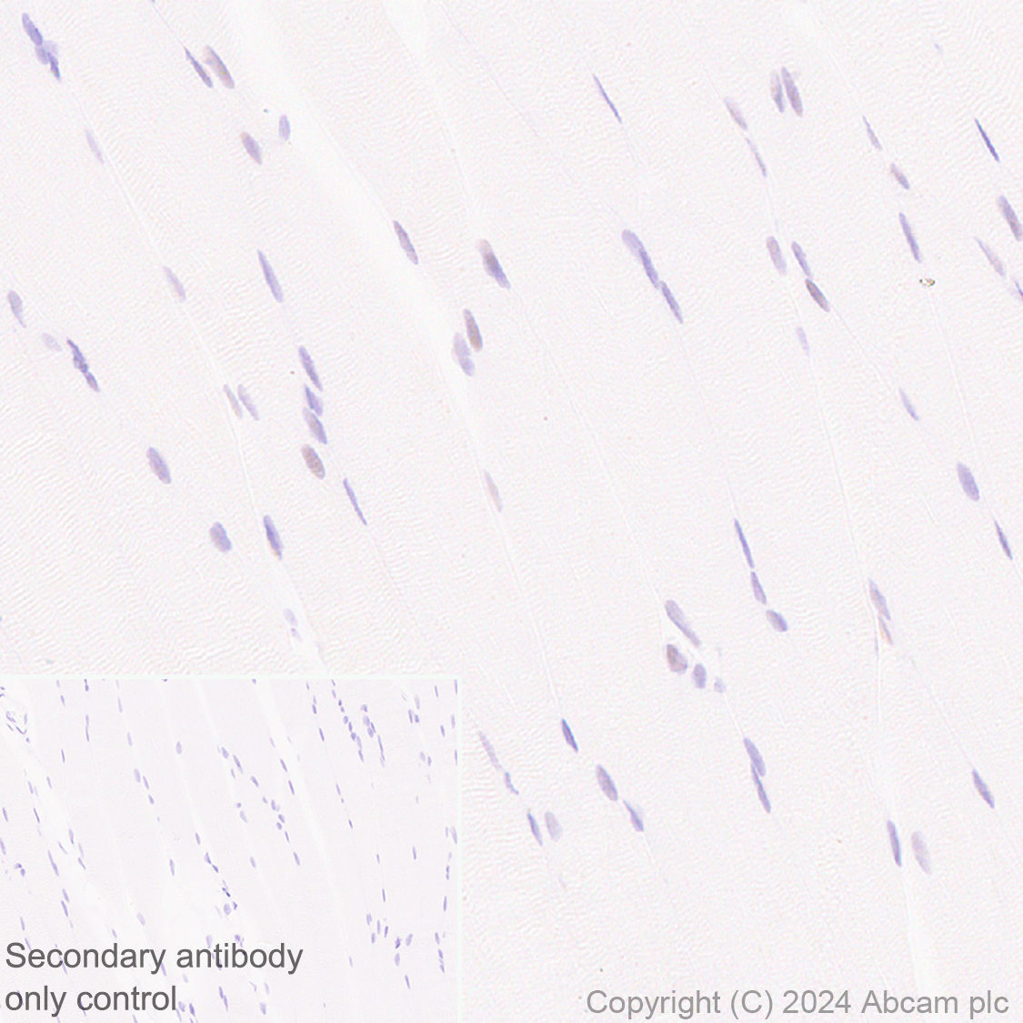 Immunohistochemistry (Formalin/PFA-fixed paraffin-embedded sections) - Anti-Cyclin K antibody [EPR28514-24] - BSA and Azide free (AB316204), expandable thumbnail