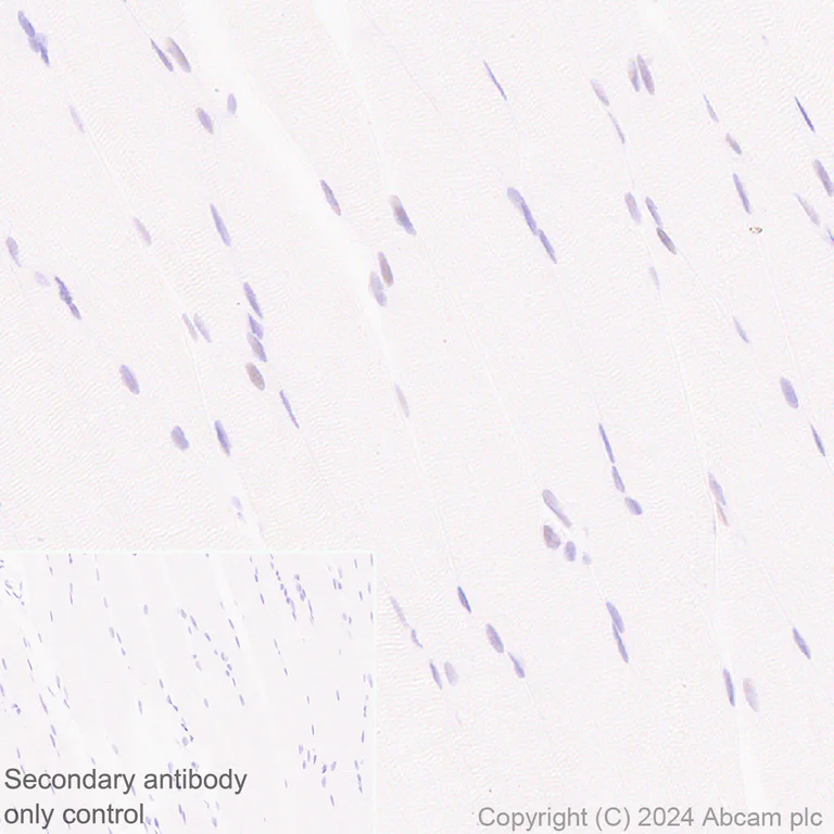 Immunohistochemistry (Formalin/PFA-fixed paraffin-embedded sections) - Anti-Cyclin K antibody [EPR28514-24] - BSA and Azide free (AB316204)