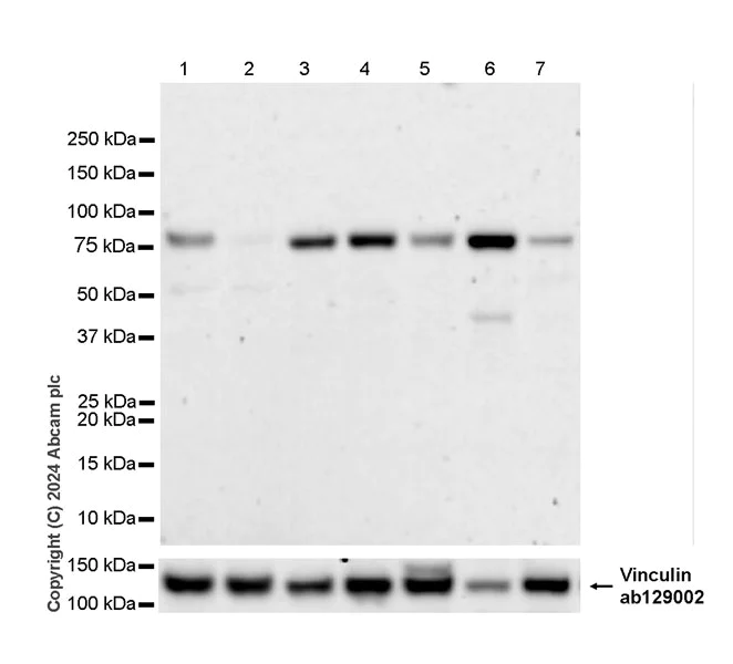 Western blot - Anti-Cyclin K antibody [EPR28514-24] - BSA and Azide free (AB316204)