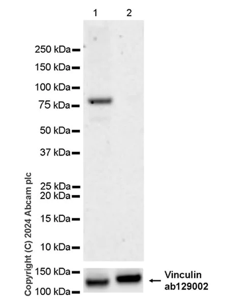 Western blot - Anti-Cyclin K antibody [EPR28514-24] - BSA and Azide free (AB316204)
