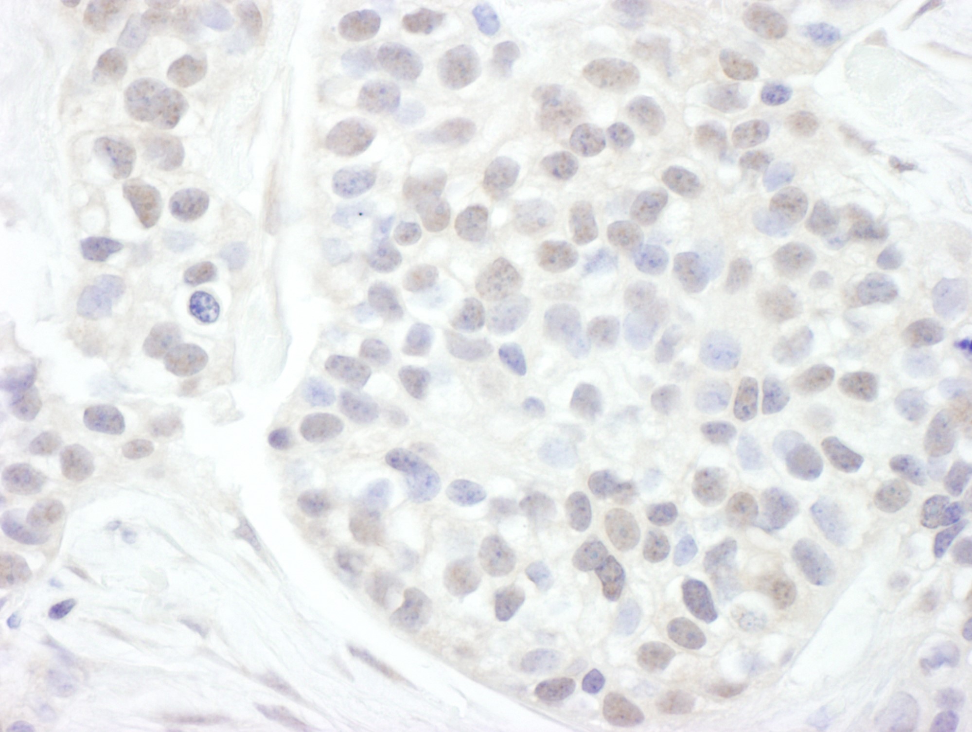 Immunohistochemistry (Formalin/PFA-fixed paraffin-embedded sections) - Anti-Cyclin T1 antibody (AB176702)