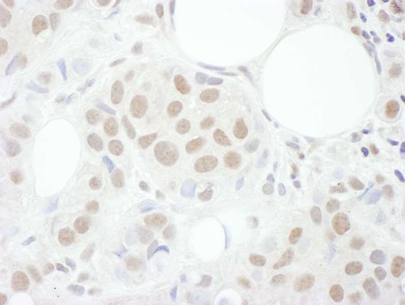Immunohistochemistry (Formalin/PFA-fixed paraffin-embedded sections) - Anti-Cyclin T1 antibody (AB264325)