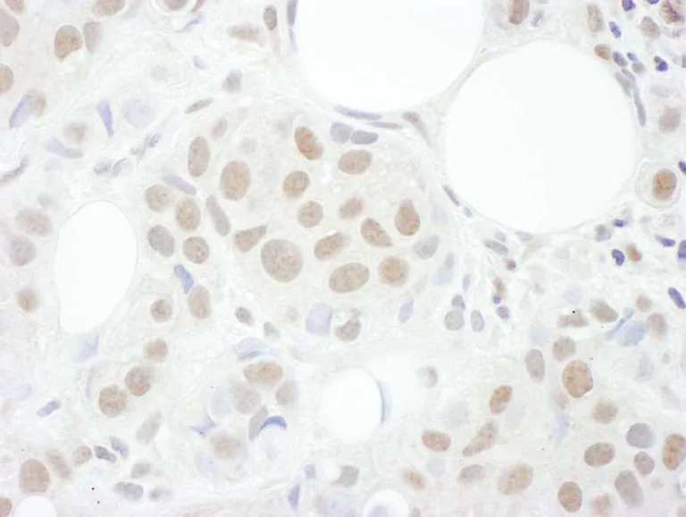 Immunohistochemistry (Formalin/PFA-fixed paraffin-embedded sections) - Anti-Cyclin T1 antibody (AB264325)