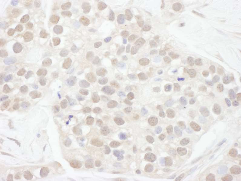 Immunohistochemistry (Formalin/PFA-fixed paraffin-embedded sections) - Anti-Cyclin T1 antibody (AB264326)