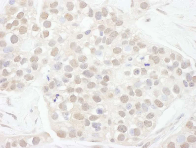 Immunohistochemistry (Formalin/PFA-fixed paraffin-embedded sections) - Anti-Cyclin T1 antibody (AB264326)