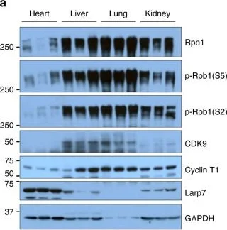 Western blot - Anti-Cyclin T1 antibody [EPR17982] - BSA and Azide free (AB238940)